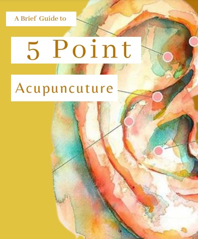 5 Point Acupuncture @ Wellness Within.uk